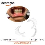 دهان بازکن دندانپزشکی بسته 5 عددی(Dental Cheek Retractor)