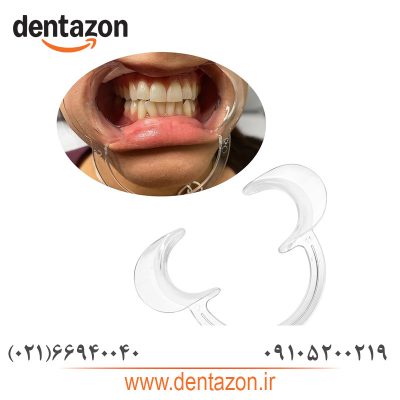 دهان بازکن دندانپزشکی بسته 5 عددی(Dental Cheek Retractor)